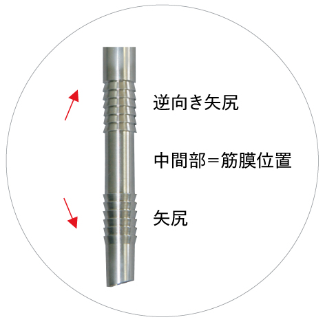 ホープポートロダン